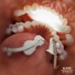RAYE – The Thrill is Gone. (Live At Metropolis)
